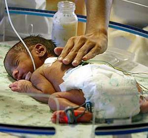 Bebês em UTI's recebem Leite do Banco de Leite Humano